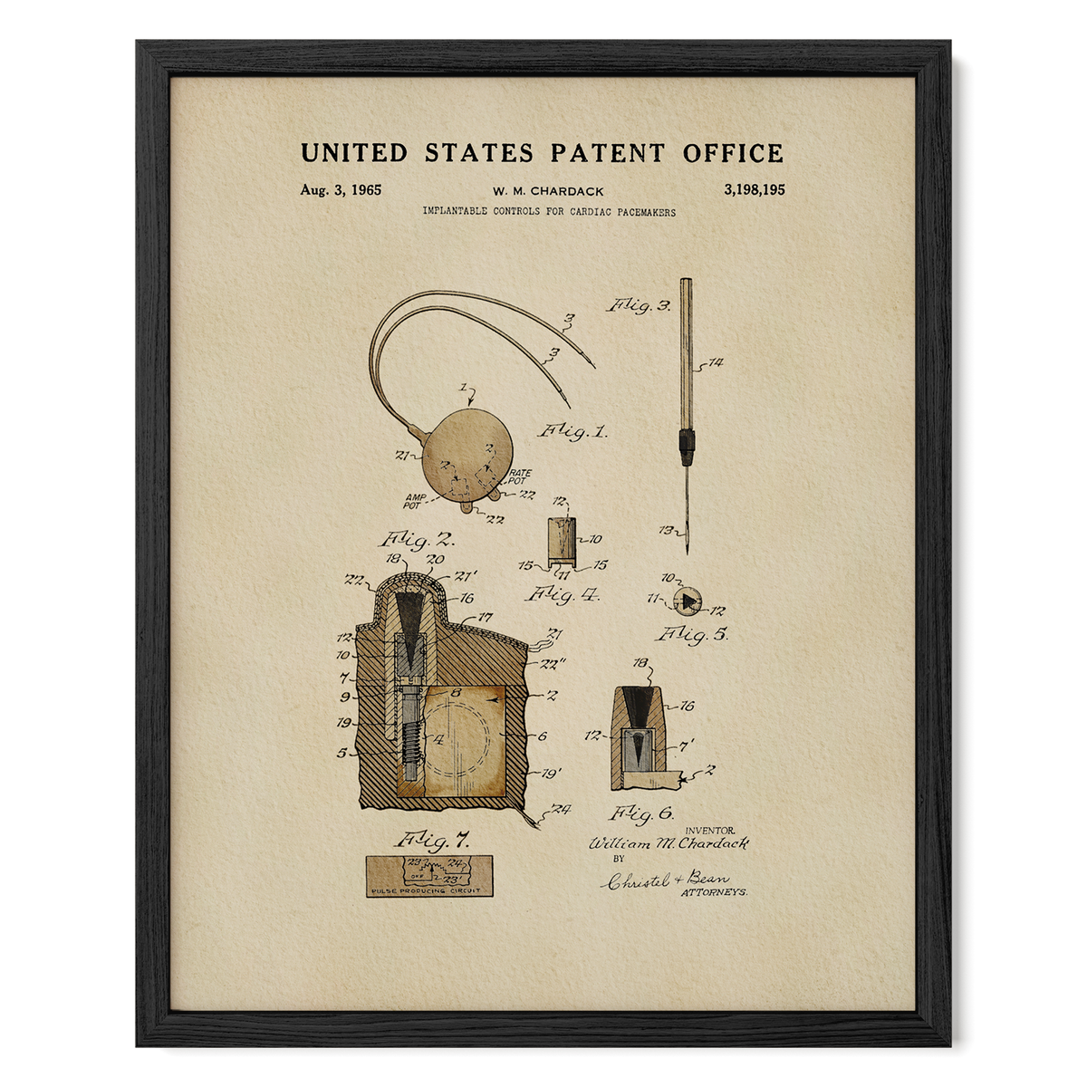 Cardiac Pacemaker Controls (1965)
