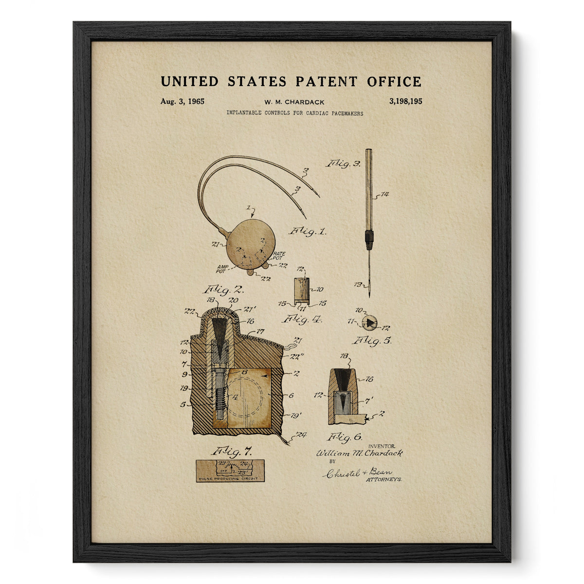 Cardiac Pacemaker Controls (1965)